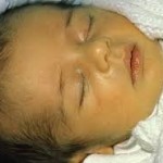 How to treat jaundice in new born baby