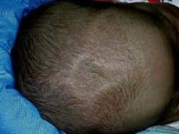 What are the soft spots on newborn baby's head